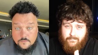 Morbid Obesity in the UK: MMA Guru is morphing into Charlie Sloth after HAIR TRANSPLANT in Turkey