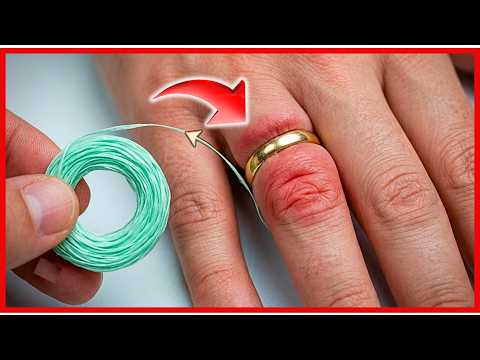 4 Increíbles formas de sacar un anillo atorado en un dedo inflamado | Gio de la Rosa