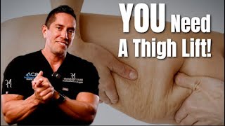 Am I a Candidate for a Thigh Lift? | Crescent vs. Full Thigh Lift Explained by Dr. Morales