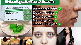 How To Use Vitamin E Capsules For Skin,Hair & Health | Evion Capsules Benefits, Uses & Review