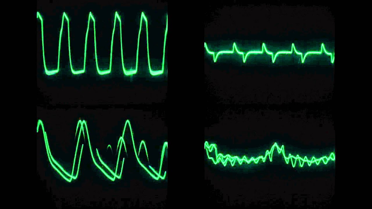 Pachelbellish — Canon in D on an analog synthesizer
