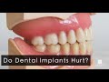 The Dental Implants Experience - Do Dental Implants Hurt?