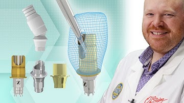 Angled Screw Channel Abutment Options