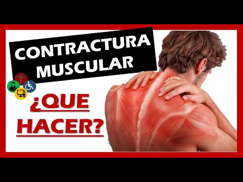 Video: ¿Puedes desgarrarte un músculo del cuello?
