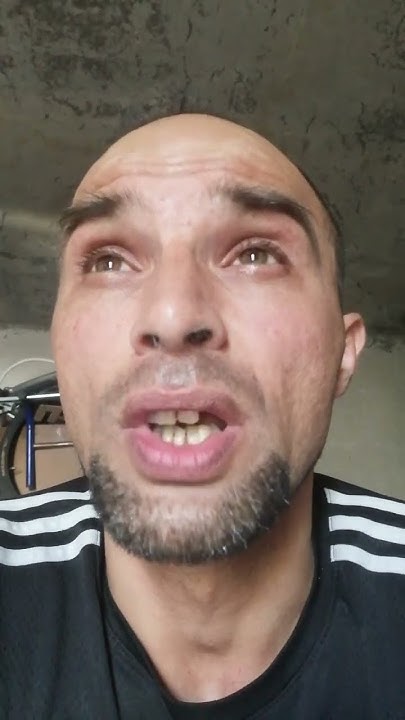 и это не козюля в носу а пыль от шпатлёвка настенное у нас ведь ремонт ...