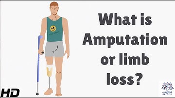 What is Amputation or Limb Loss?
