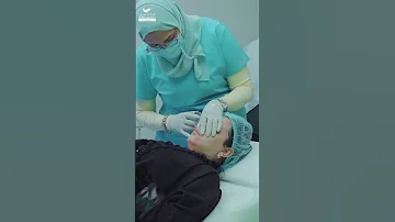 فيلر شفايف 