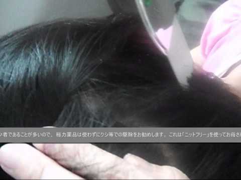 頭しらみ（アタマジラミ）駆除の方法 head lice combing