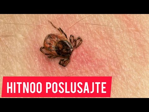 Video: Najbolja Tehnika Za Opuštanje