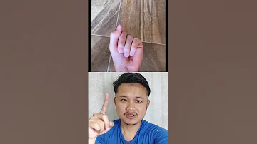 He Has Four Fingers Trending Viralvideo Funny Shorts 