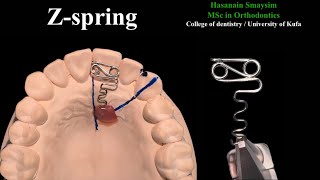 Z spring wire bending, design animation, activation and action simulation (voiced tutorial)