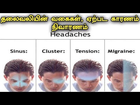 தலைவலியின் வகைகள், ஏற்பட காரணம், நிவாரணம் | Reason and Solution for Headache