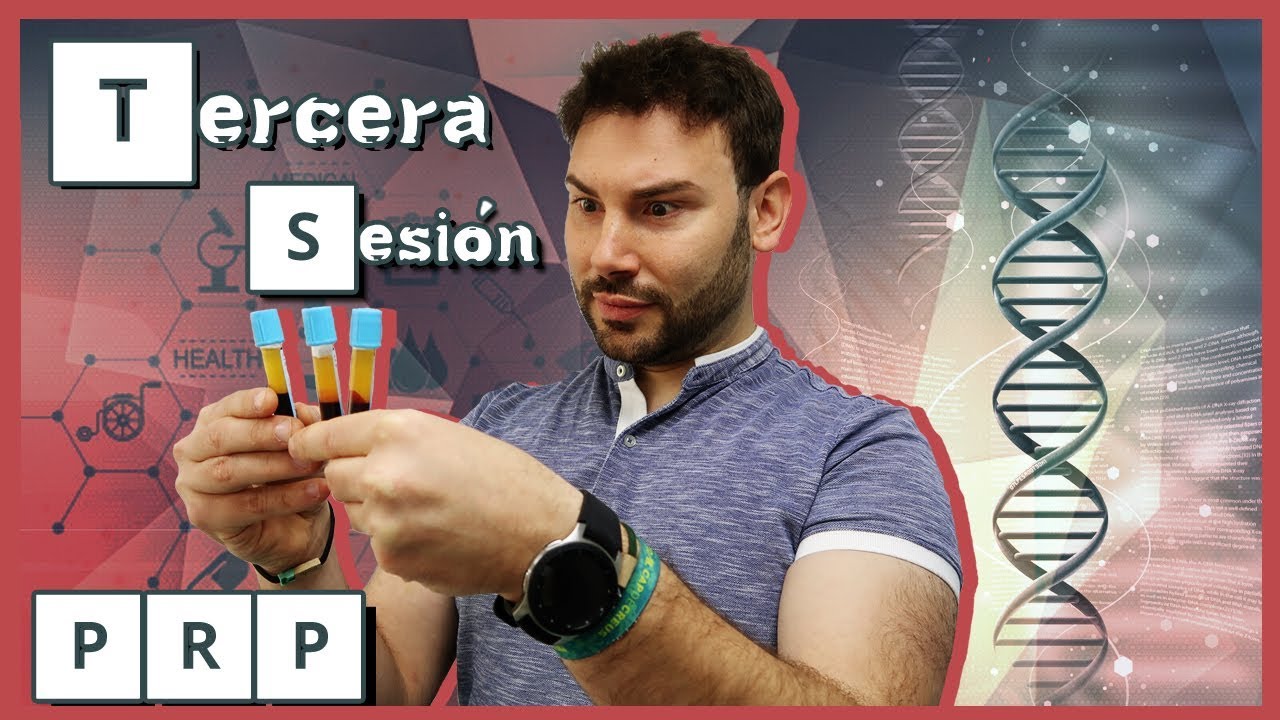 Tercera sesión de PRP - Plasma rico en plaquetas