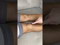 ¿Sufres de dolor en la rodilla? ¡Prueba este método simple y casero!