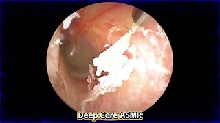 deepest asmr ear cleaning for brain melting tingles