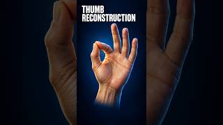 Thumb Reconstruction