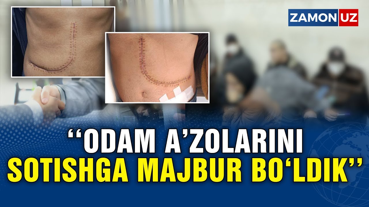 TOSHKENTDA BUYRAK-JIGAR SAVDOSI BILAN SHUG‘ULLANGANLARGA HUKM O‘QILDI