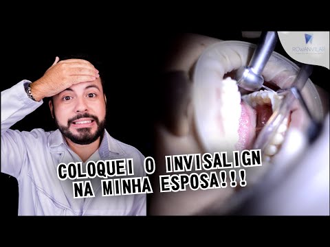 Vídeo: Como colocar uma nova bandeja Invisalign (com fotos)