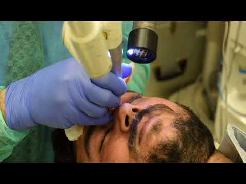 Removal of Acne Scar through Laser `by the Skin Specialist Prof. Dr. Ikram Ullah Khan