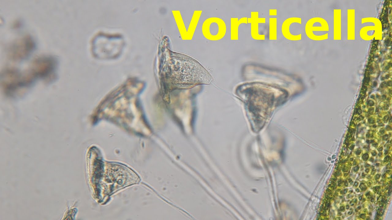 Vorticella - Under the Microscope - YouTube