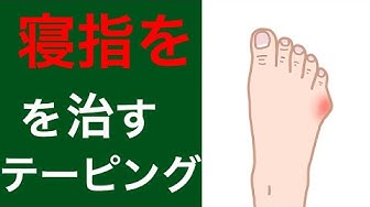 内反小趾 Youtube