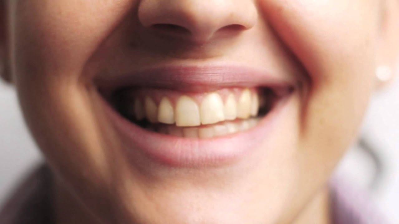 Lynnwood Dentist, Everett Dentist, Shoreline Dentist, Smile Now Dental