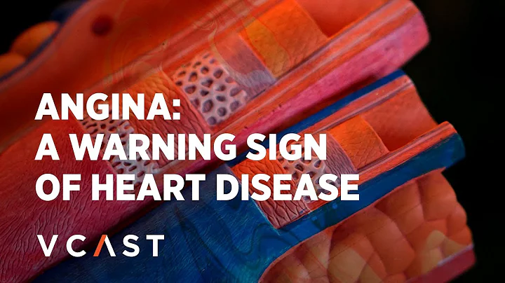 Dr Osman Faheem | Cholesterol and Angina - the pro...