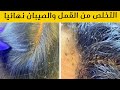 طريقة التخلص من القمل والصيبان في يوم واحد نهائيا 