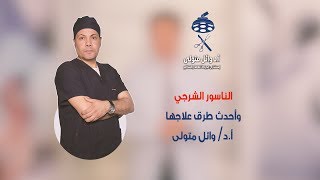 حلقة (3) الناسور الشرجي أ.د وائل متولى