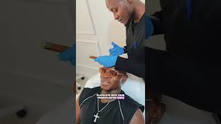 Kenyan dancer Tileh Pacbro shows the progress of his hair transplant after 4 months
