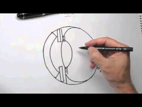 Sketch - Glaucoma and Optic Nerve damage