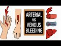 Bleeding Control for EMTs and Paramedics | NREMT Prep