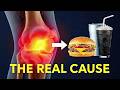 The REAL Cause of Joint Pain (It’s Not Aging). Stop Doing This Every Day