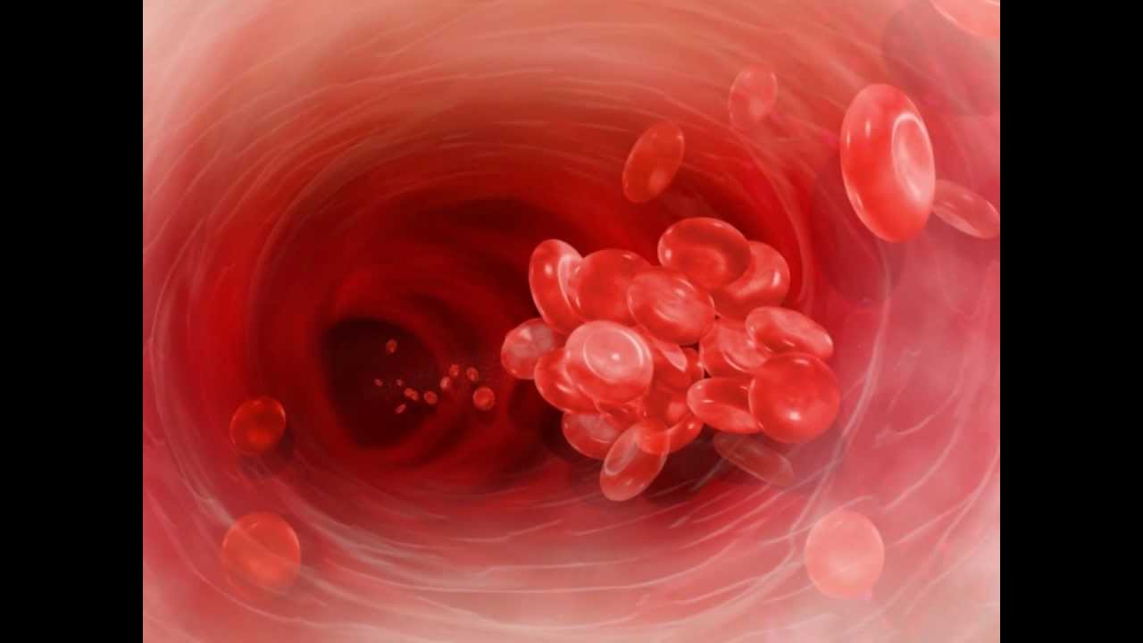 SEARCH AND BUY THIS PRODUCT Hypersensitivity Type 2: ABO transfusion reaction - YouTube