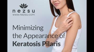 Minimizing the Appearance of Keratosis Pilaris