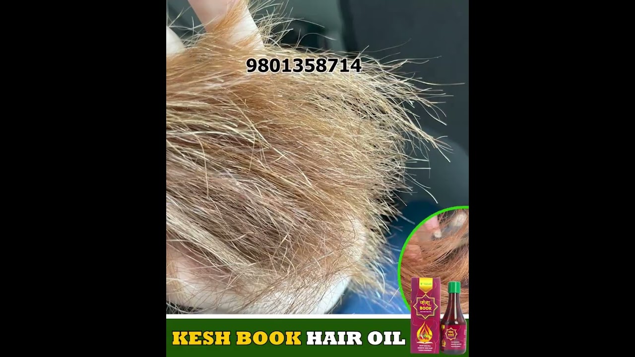 🔥 Kesh Book Hair Oil Review – 100% Natural Solution for Hair Growth & Hair Fall Control! 🌿✨