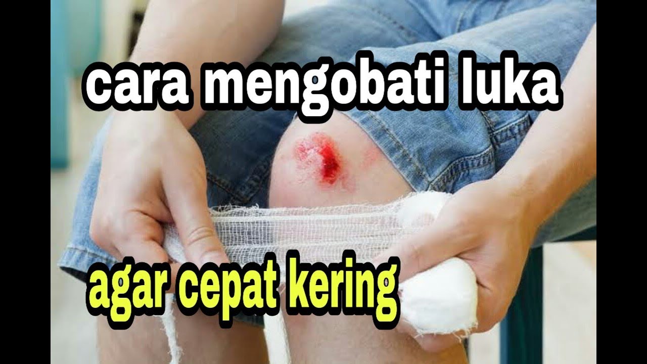 Mengobati luka saat terjatuh(obat kuno tradisional)pengganti obat merah