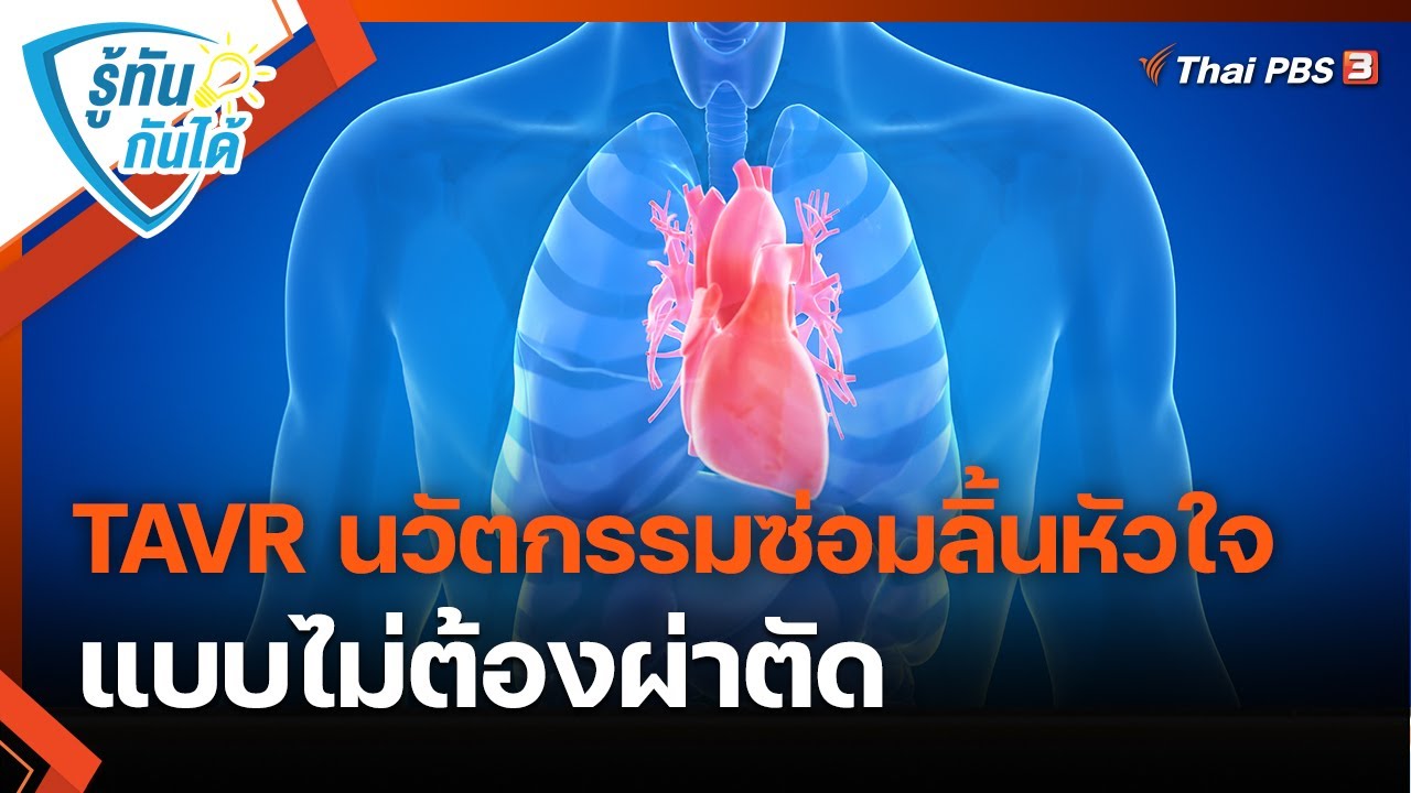 TAVR นวัตกรรมซ่อมลิ้นหัวใจ แบบไม่ต้องผ่าตัด | รู้ทันกันได้ | วันใหม่วาไรตี้