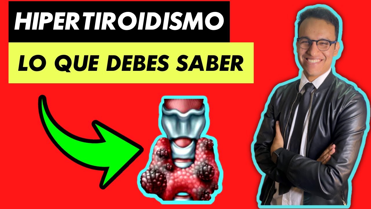 hipertiroidismo-todo-lo-que-debes-de-saber-causas-diagn-stico