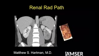 Kidney/renal radiology pathology correlation