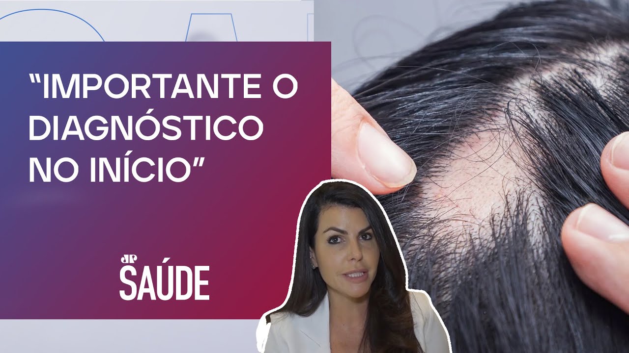 Alopecia cicatricial: O que é e qual melhor tratamento? Dermatologista explica | Dra. Ana Carina