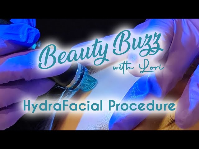 Beauty Buzz with Lori: HydraFacial Procedure