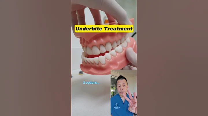 Transform Your Smile: 3 Underbite Correction Options You Need to Know! #shorts #dentallan