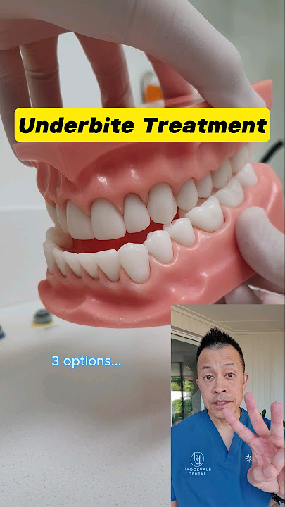 Transform Your Smile: 3 Underbite Correction Options You Need to Know! #shorts #dentallan