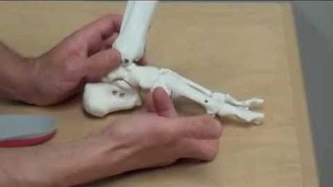 Sesamoiditis - Foot Orthotics