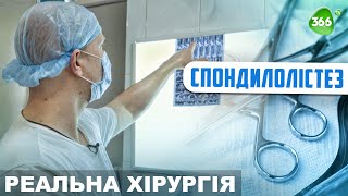 Грижа у Поперековому Відділі Хребта Травматичного Характеру зі Зміщенням хребця.