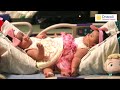 Formerly conjoined twins in South Texas still closer than ever 5 years after separation surgery
