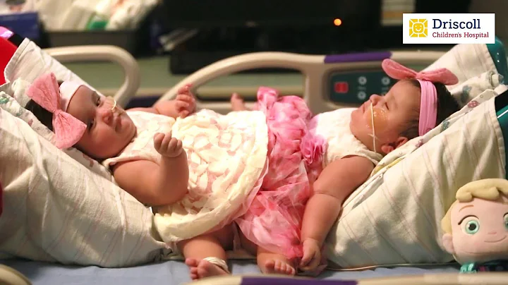 Formerly conjoined twins in South Texas still clos...