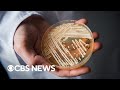 CDC warns of drug-resistant fungal infection - CBS News