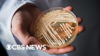 CDC warns of drugresistant fungal infection